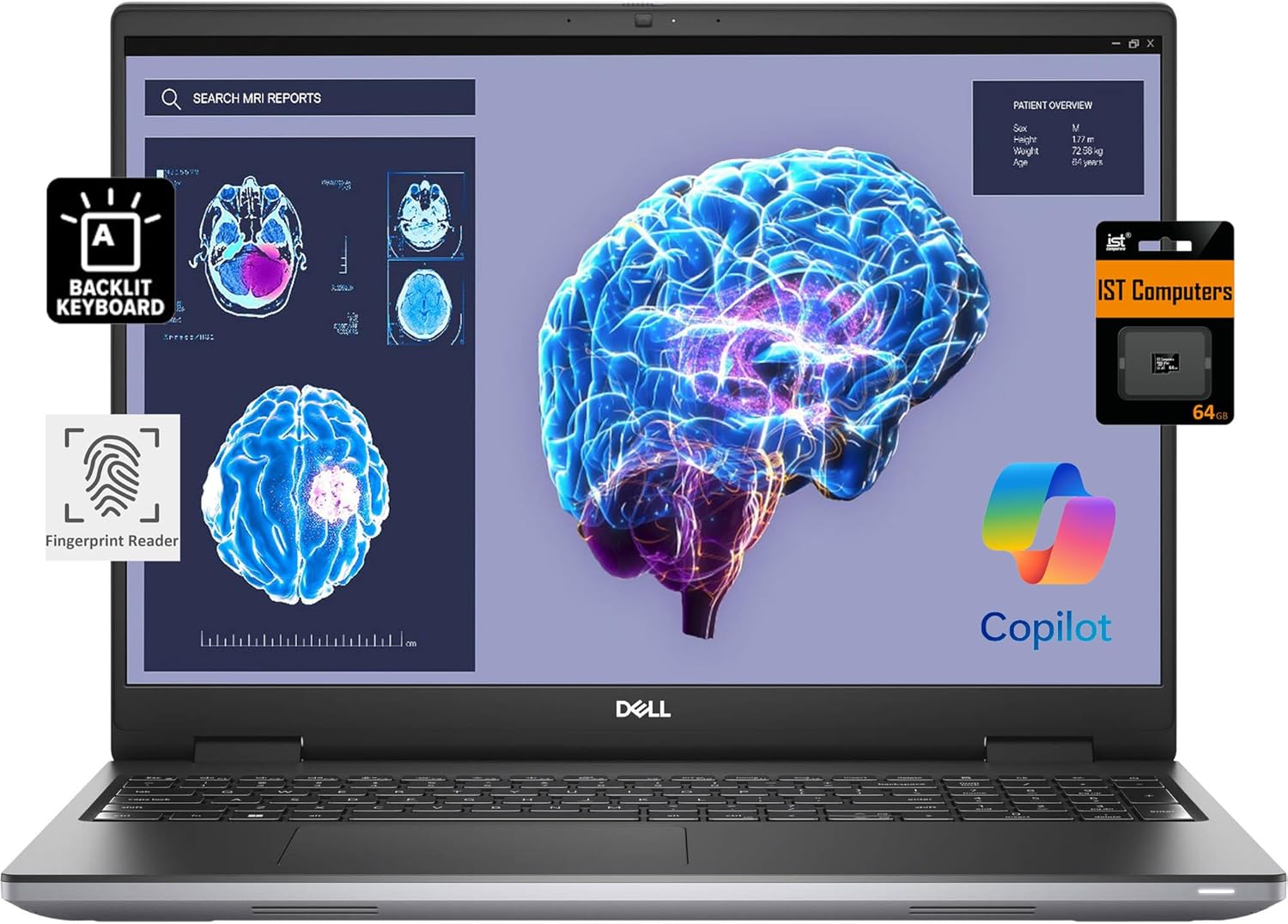 Dell Precision 7670 RTX A2000 Mobile Workstation
