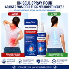NervoZen™ Spray Neuropathie | Stoppez picotements et engourdissements dès la première application !